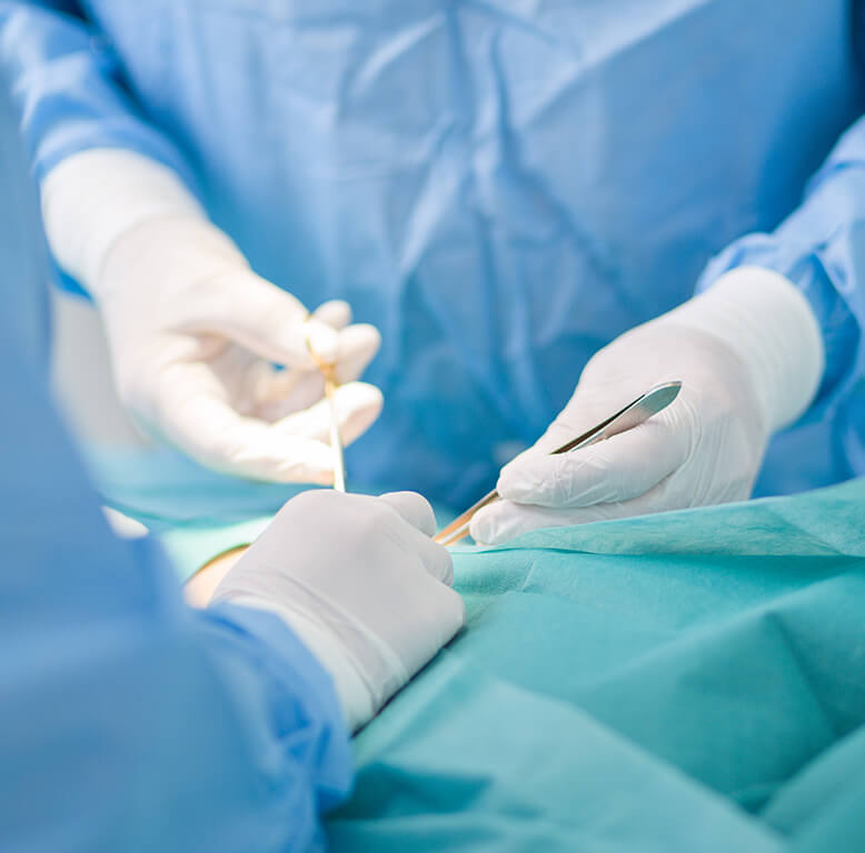 患者の手術を行う医師のイメージ