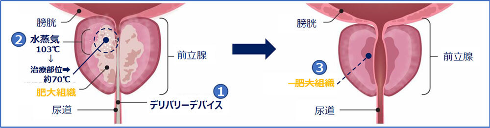 治療の概要（図1）