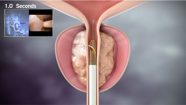 治療の概要（図2）