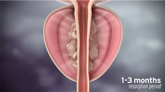 治療の概要（図3）
